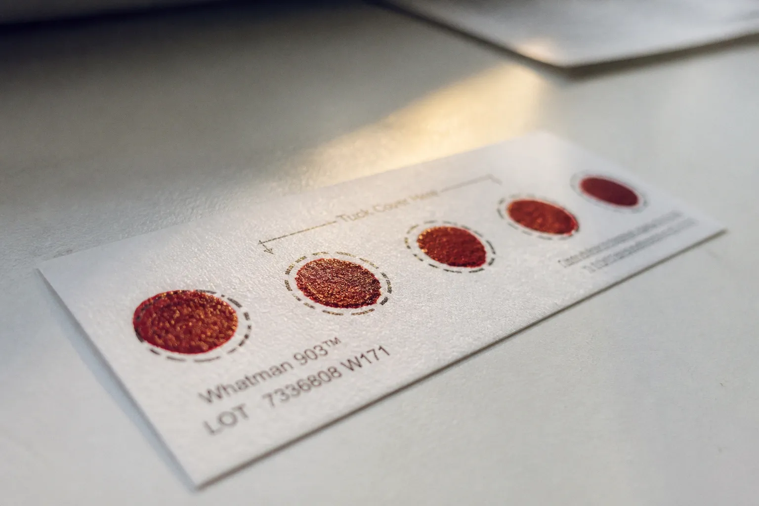 False Positive SCID Screens: Common Causes